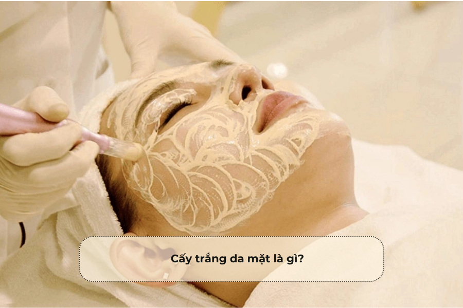 Cấy trắng da mặt là gì