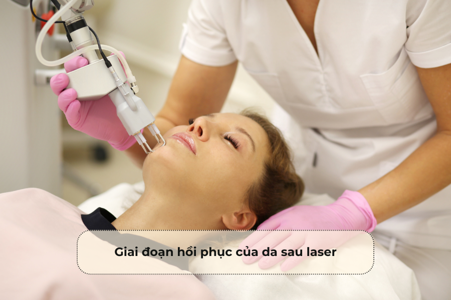 Giai đoạn hồi phục của da sau laser