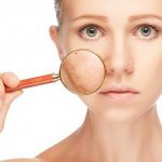 Da nám có nên dùng retinol không? Những lưu ý khi dùng để có làn da đẹp