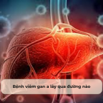 Bệnh viêm gan A lây qua đường nào? Những điều bạn nên biết để phòng tránh