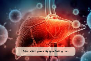 Bệnh viêm gan a lây qua đường nào