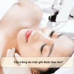 Cấy trắng da mặt giữ được bao lâu? Giải đáp chi tiết từ chuyên gia da liễu