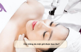 Cấy trắng da mặt giữ được bao lâu