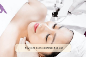 Cấy trắng da mặt giữ được bao lâu