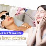 Cách chăm sóc da sau khi bắn laser trị nám: Bí quyết phục hồi và ngừa tái phát