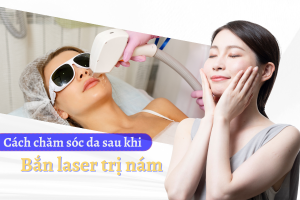 cách chăm sóc da sau khi bắn laser trị nám_