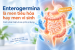 Enterogermina là men tiêu hóa hay men vi sinh? Cách phân biệt và lưu ý khi sử dụng